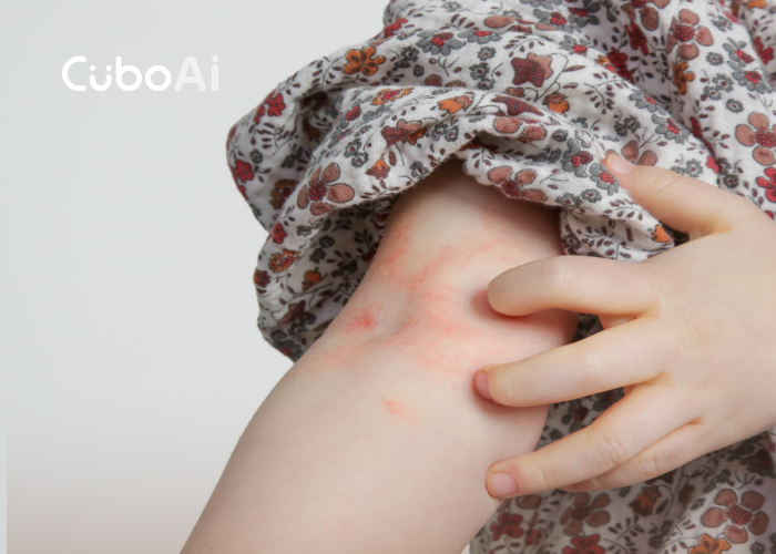 告別抓不停的夜晚！讓異位性皮膚炎不再打擾寶寶